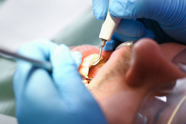 Best Urgent Care for Lost Fillings or Crowns in Cache, OK
